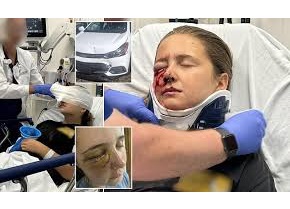 Ohio Teenage girl’s eye suffers devastating explosion after sun glare causes low-speed crash near her school