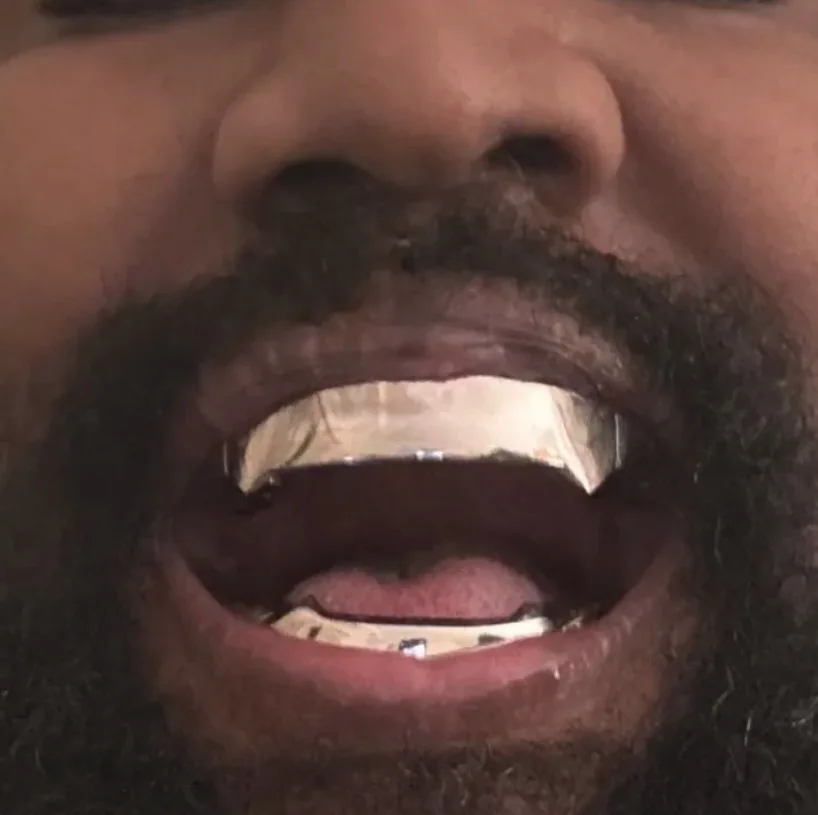 Kanye West Unveils Terrifying Album Cover for Bully in Tokyo as Controversies Surround His Dental Transformations and Personal Life